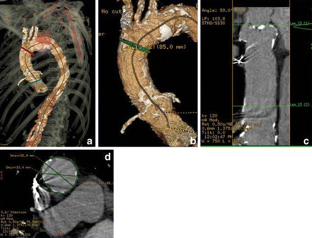 figure 24