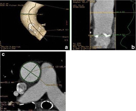 figure 25