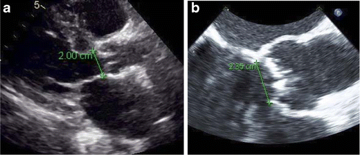 figure 26