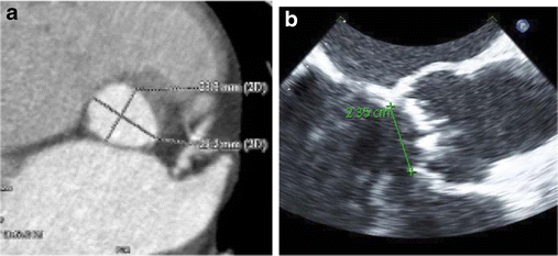 figure 27