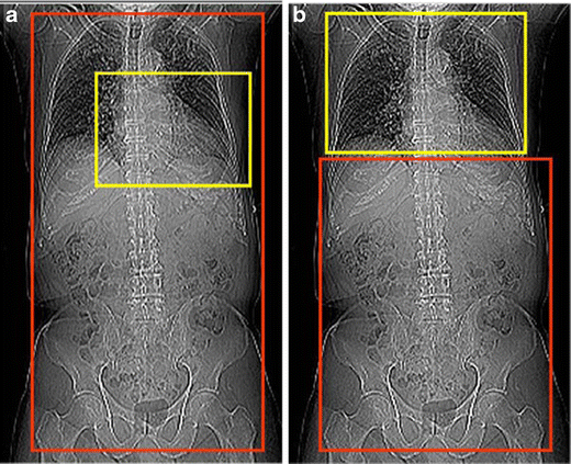 figure 28