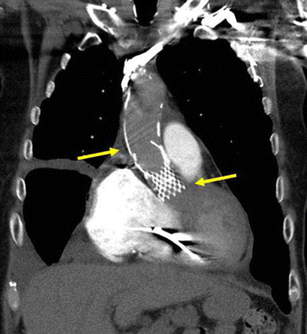 figure 29