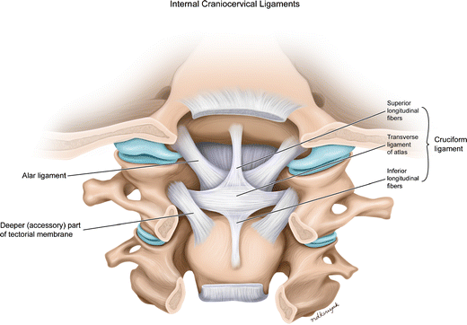 Mdct And Mri Evaluation Of Cervical Spine Trauma Springerlink