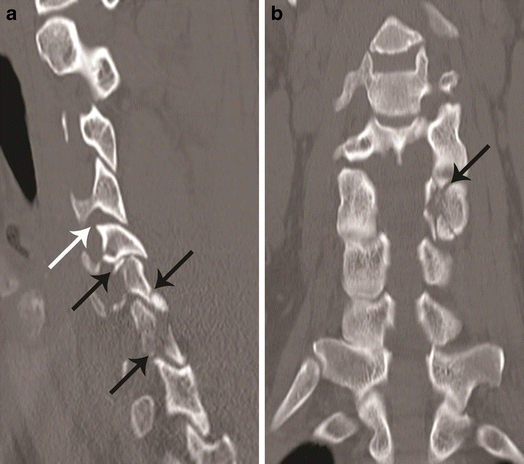 figure 17