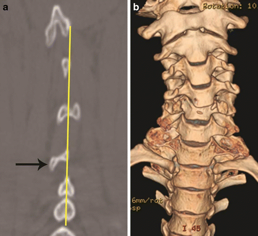 figure 24