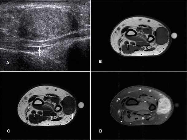 figure 20