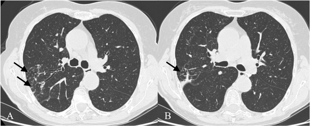 figure 18