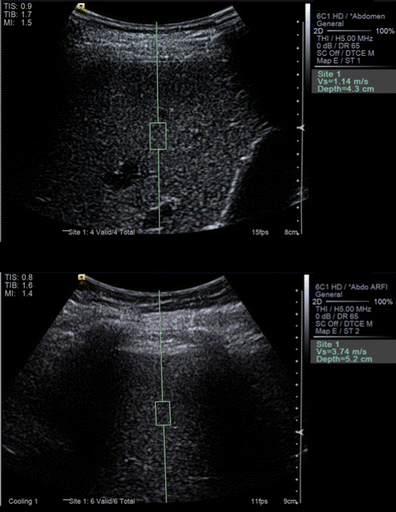 figure 9