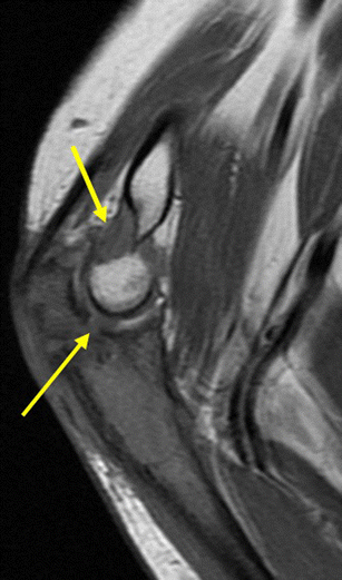 figure 21