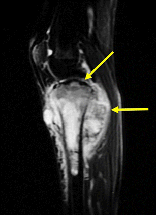 figure 22