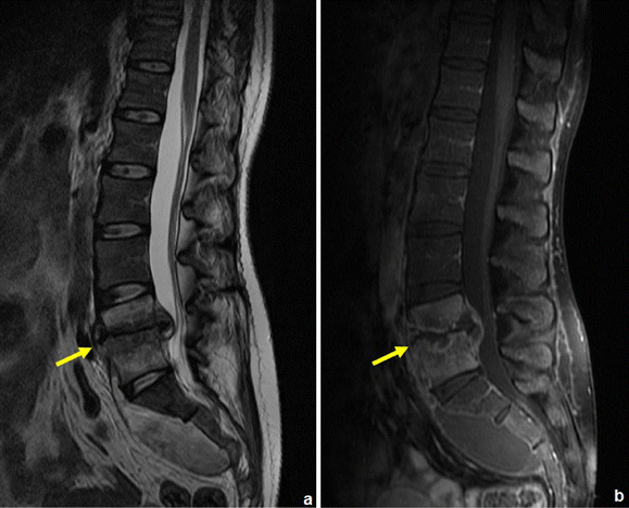 figure 28