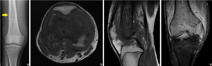 figure 29