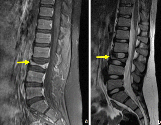 figure 30