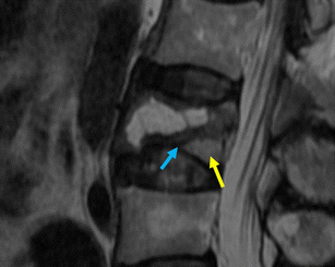 figure 31