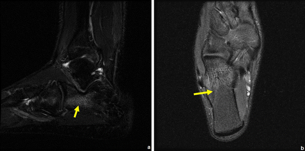 figure 32