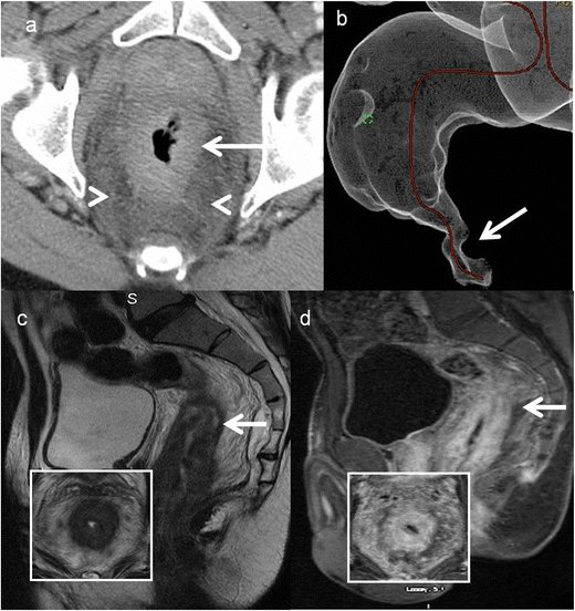 figure 17