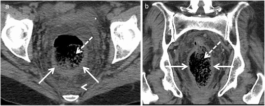 figure 18