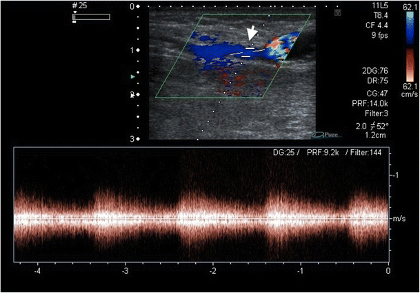 figure 18