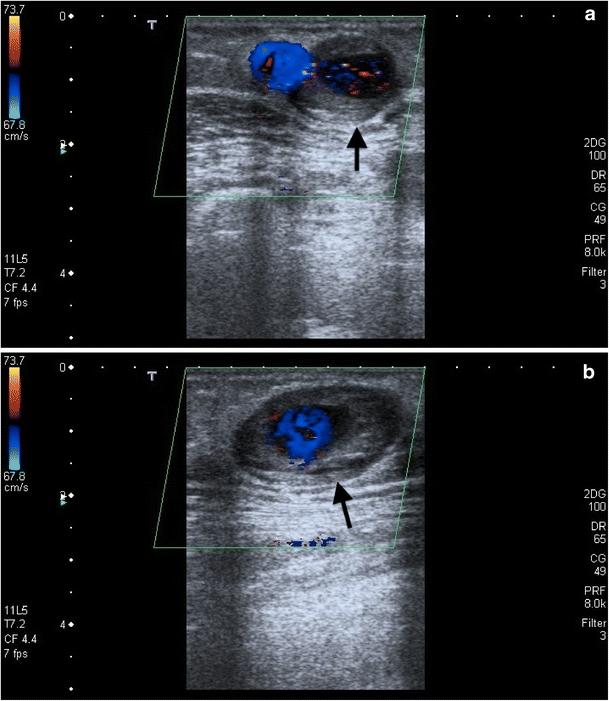 figure 22