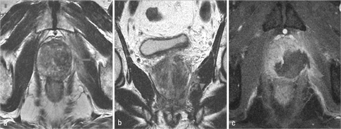 figure 23