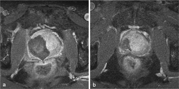 figure 24