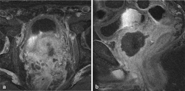 figure 25