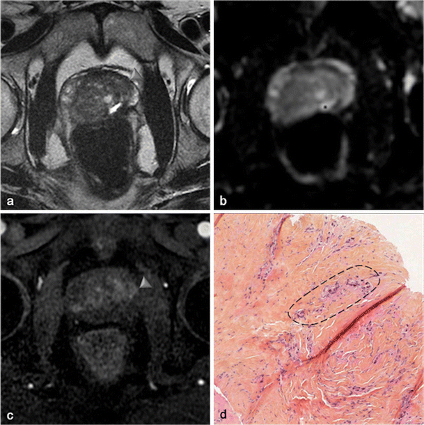 figure 29