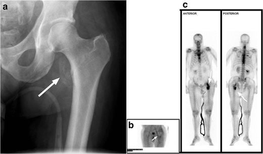 figure 19