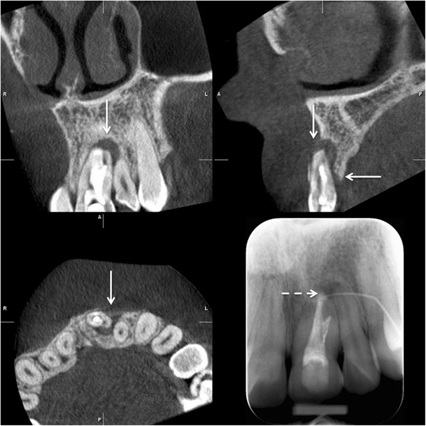 figure 14