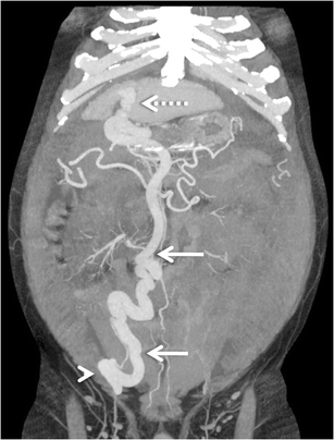 figure 19