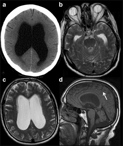 figure 17