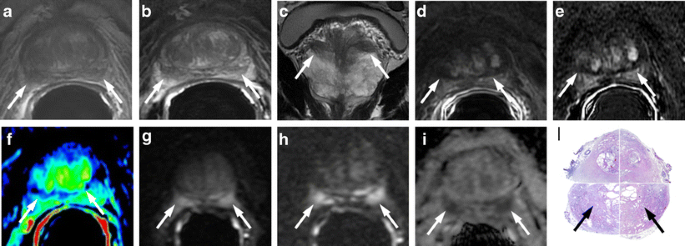 Prostate MRI Essentials - Tirkes, Temel; (szerk.) - Prospero Internetes Könyváruház