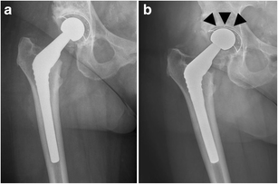 figure 25