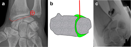 figure 8