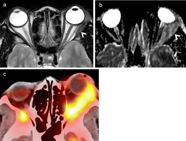 figure 19