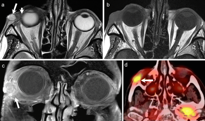 figure 22