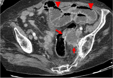 figure 19