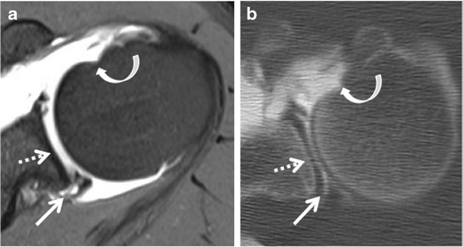 figure 15