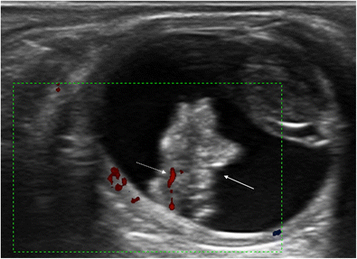 figure 11