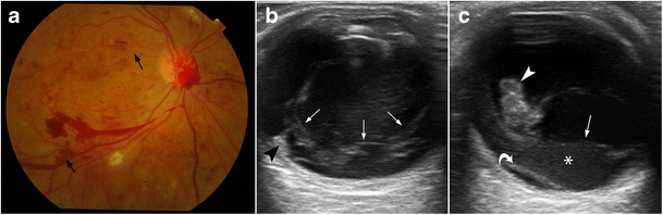 figure 19