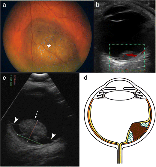 figure 21