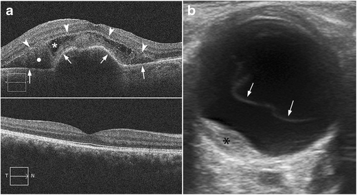 figure 23