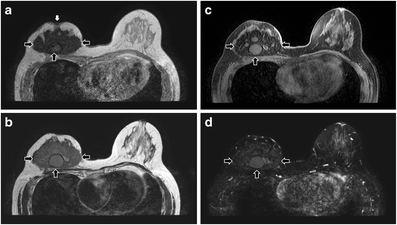 figure 23