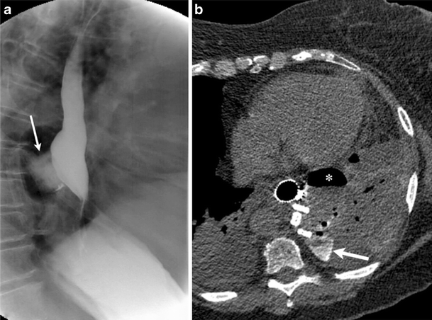 figure 22