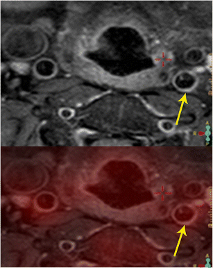 figure 17