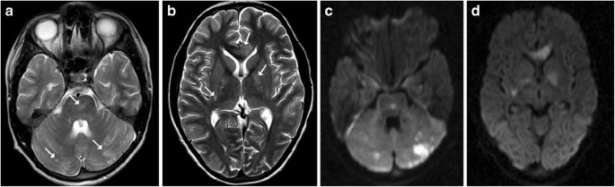 figure 24