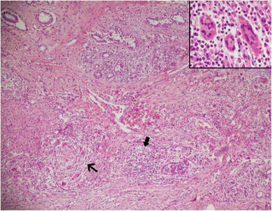 figure 14