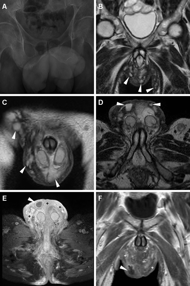 figure 21