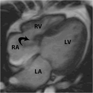 figure 16