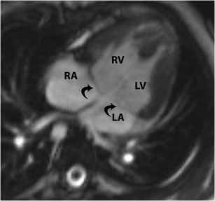 figure 18